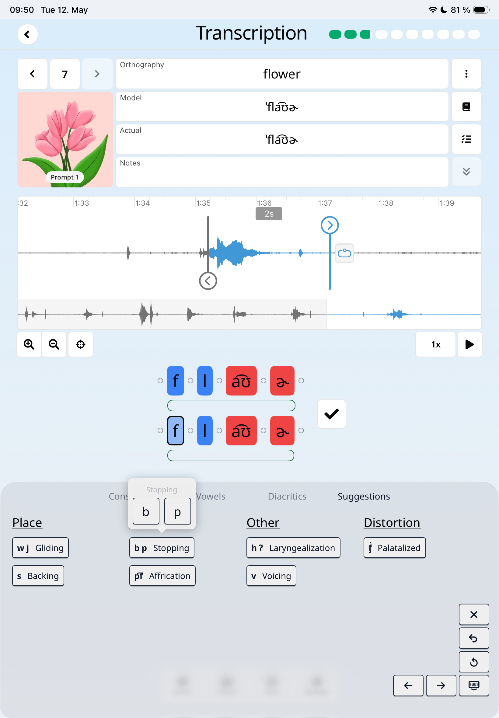 SpeechCatcher iPad App - Transcribe quickly and effortlessly